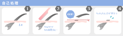 剃ると毛が太く見えるのはなぜ 毛が濃くなる原因はカミソリにあらず うる肌コラム