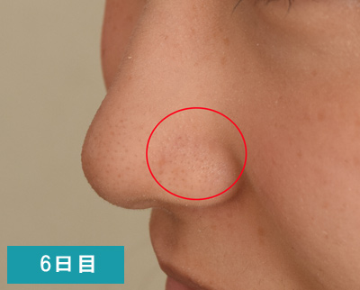 検証 顔そりエステの効果はいつまで続く 肌の変化をレポート うる肌コラム
