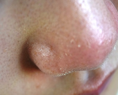 小鼻に生えている黒い産毛をカミソリで処理してみた うる肌コラム