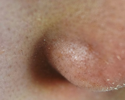 小鼻に生えている黒い産毛をカミソリで処理してみた うる肌コラム