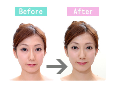 【４人目Before→After 】「キツくみえるのが嫌」などの顔立ちの悩みもプロの眉カットで解決！