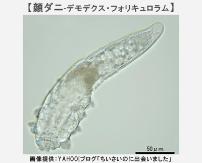 肌トラブルの原因となる「顔ダニ」の繁殖を抑える方法