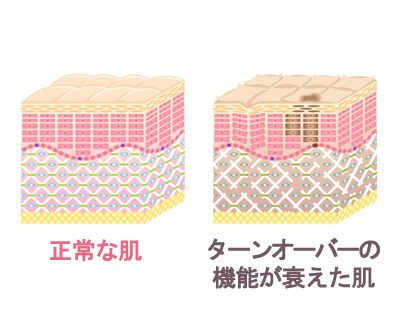 年齢を重ねるとシミができやすいのは肌のターンオーバーの衰えが原因