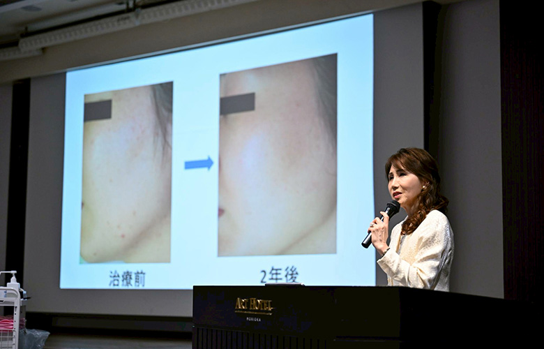 美容皮膚科医 赤須玲子先生による「顔そり」スキンケアセミナー