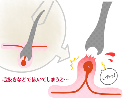 小鼻に生えている黒い産毛をカミソリで処理してみた うる肌コラム